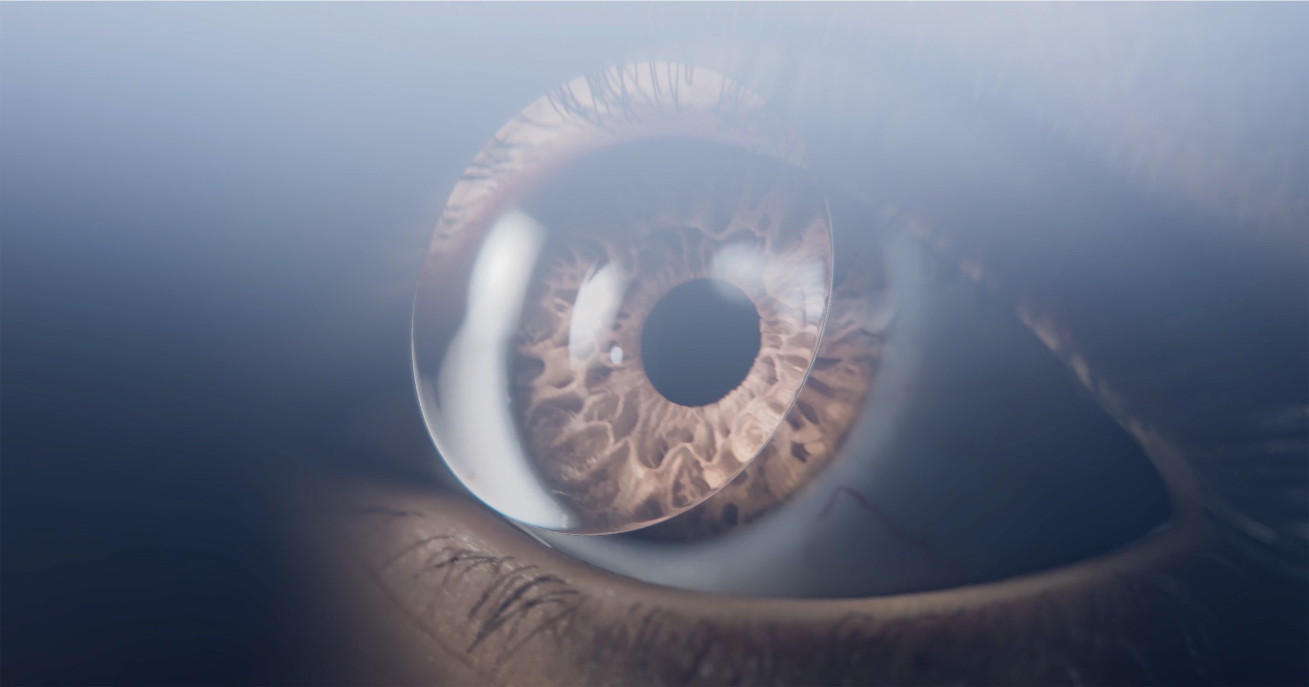 3D animation of Lynthera drug delivery lens being placed on eye.jpg